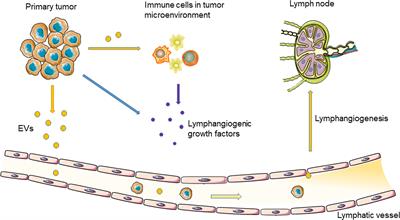 Role of Extracellular Vesicles on Cancer Lymphangiogenesis and Lymph Node Metastasis